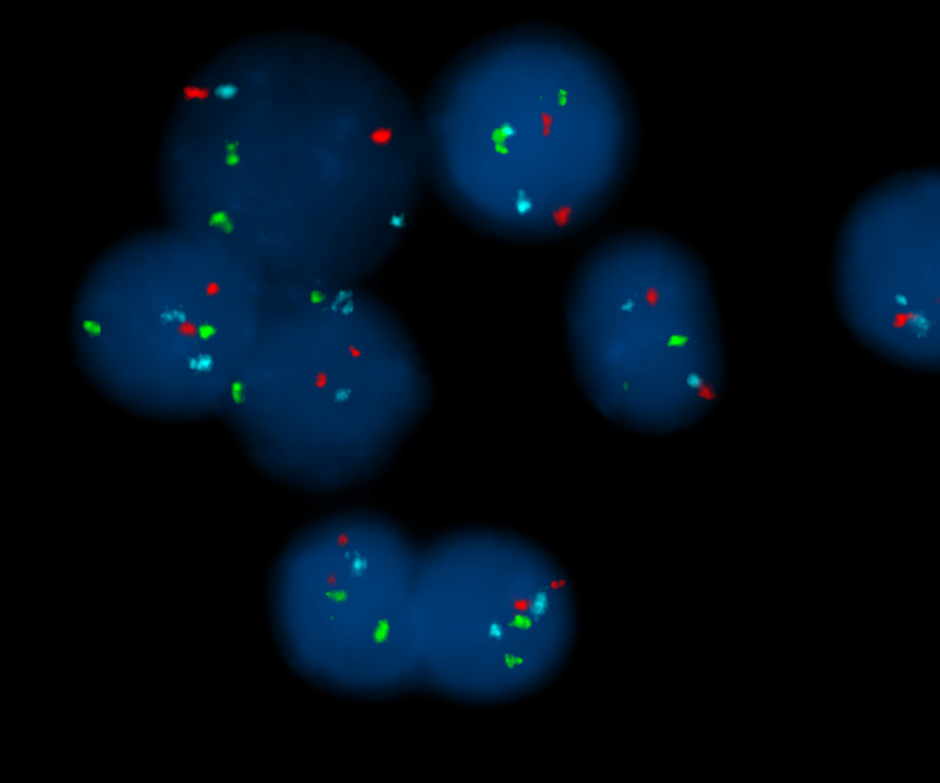 Fluorescence In Situ Hybridization Wikipedia